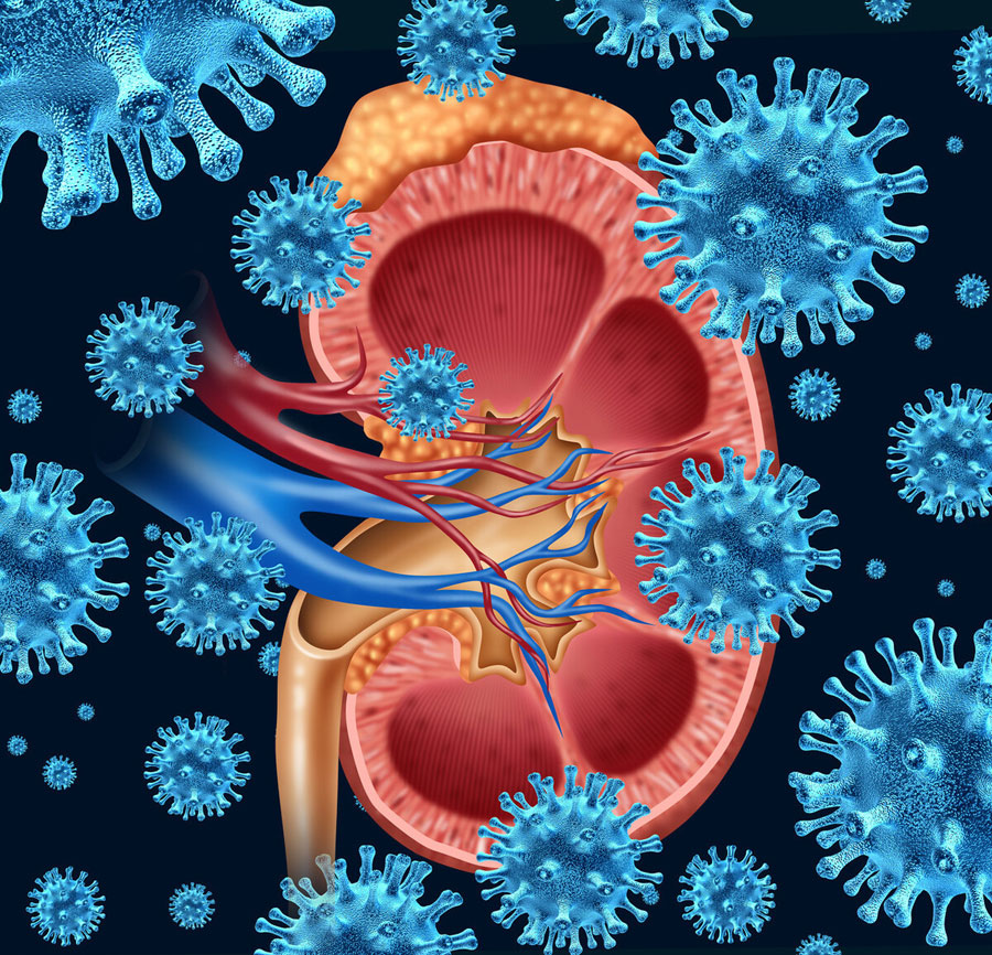 诱发肾癌的原因有哪些？肾癌多半是这4个诱因引起，你了解多少？