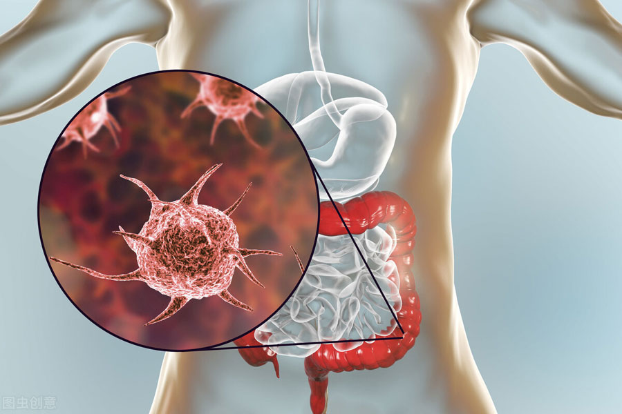 结肠癌患者治疗期间如何护理呢？结肠癌患者饮食注意什么？肿瘤专家给出建议